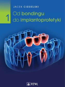 Implantologia z implantoprotetyką