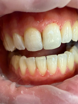 Stomatologia estetyczna